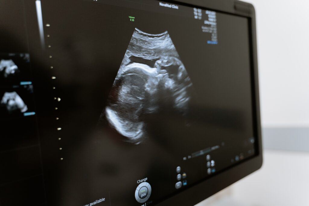 ultrasound birth defect child injury chicago